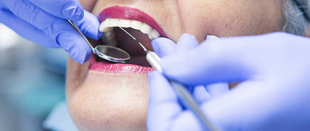 Best Chipped Tooth Repair Near Me  in Ottumwa, IA